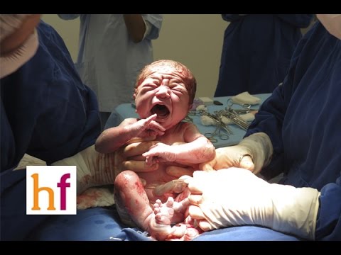 Test de apgar neonatal